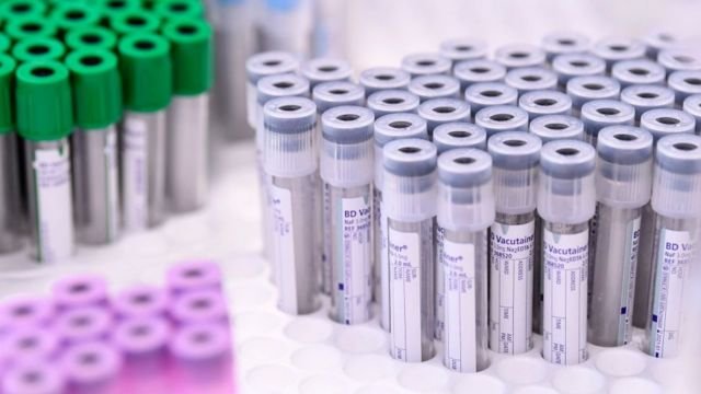Covid-19 : l’Ordre des médecins du Burkina porte plainte contre les personnes impliquées dans l’essai clinique sur l’Apivirine
